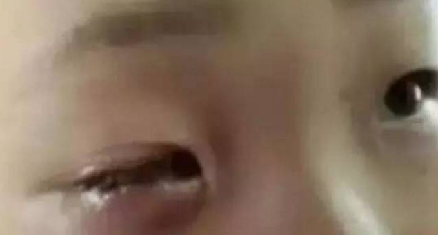 【暑期防范】這東西家家都有，千萬要防范！