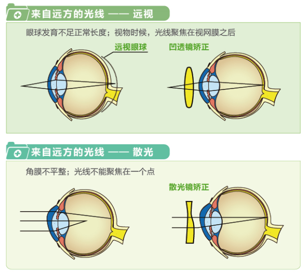 【看圖解】一張圖教你看懂近視、遠視和散光