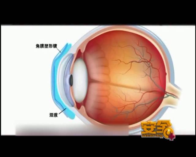 一夜之間真的能改變視力嗎？